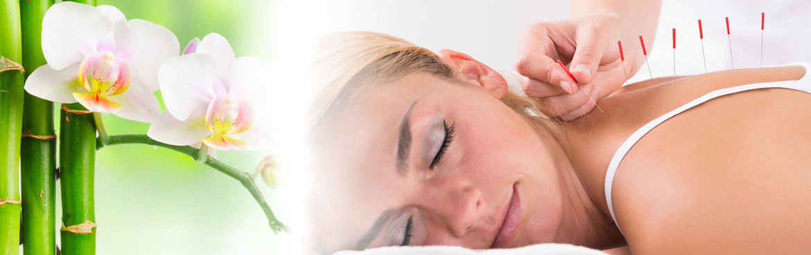SHAPE Toronto Acupuncture FAQs